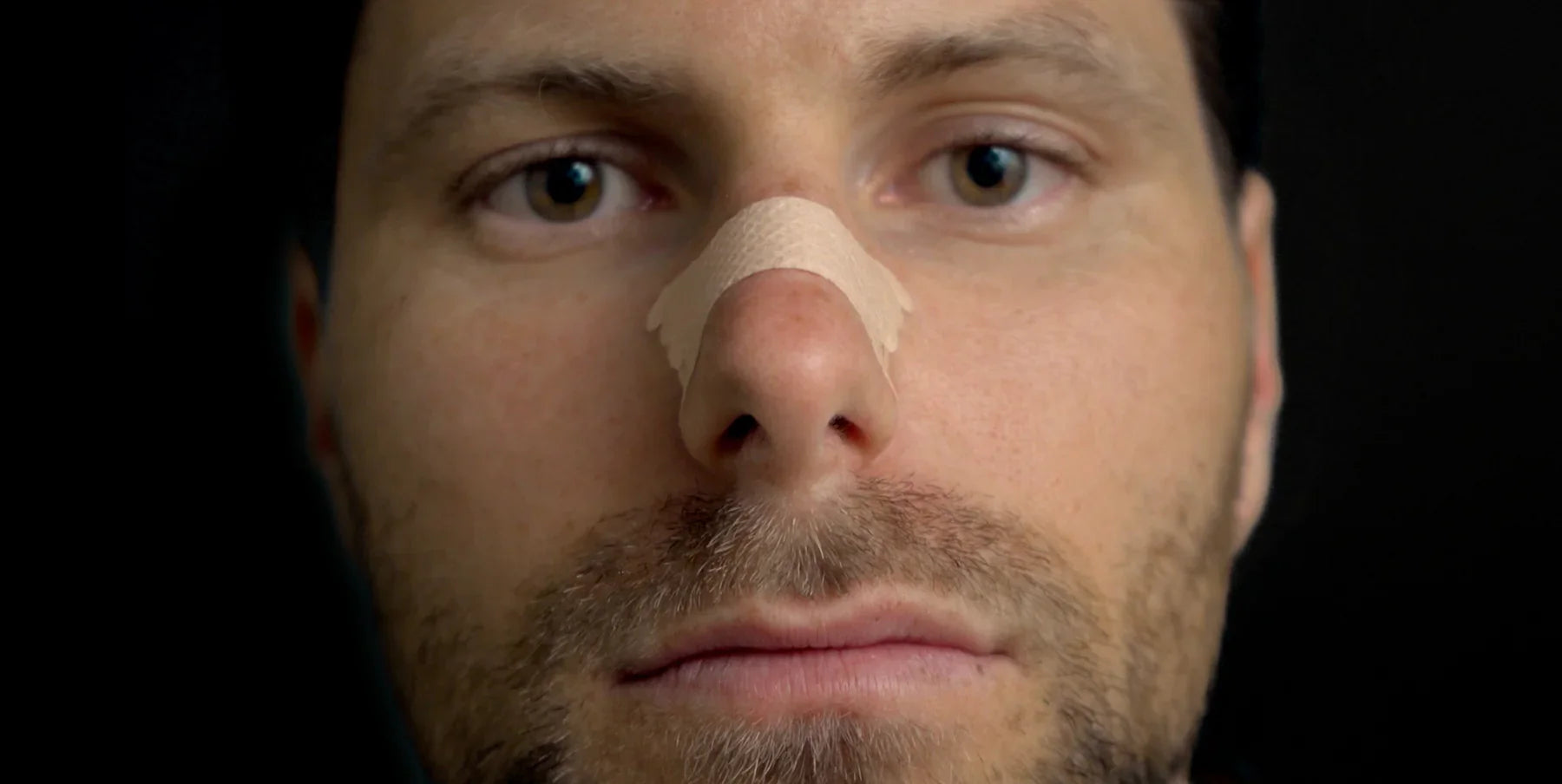 Obične Trake za Nos